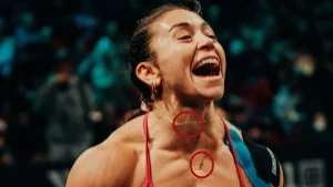 Le PAM a édité la photo de Fee Saghafi ; Retirer